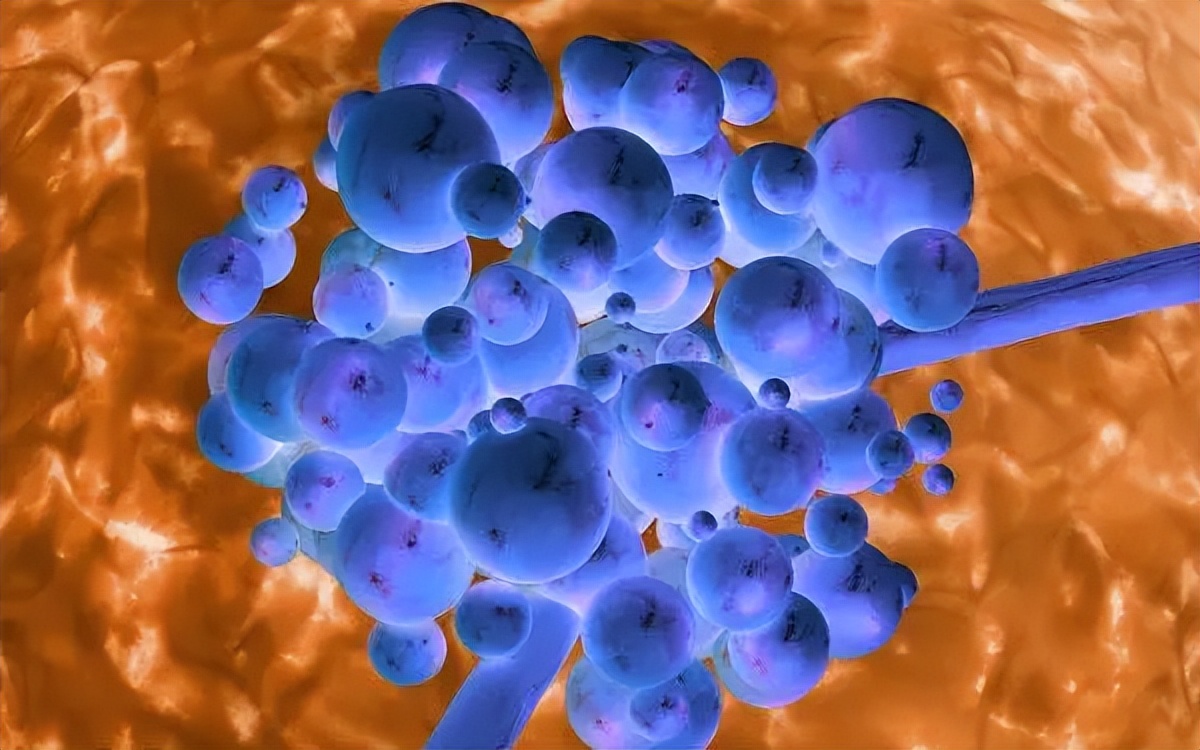 皮肤念珠菌病是什么症状,皮肤念珠菌病传染吗