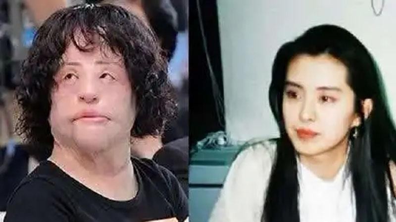 韩慧景整容是打了玻尿酸了吗,2004年整容狂魔韩慧景的故事
