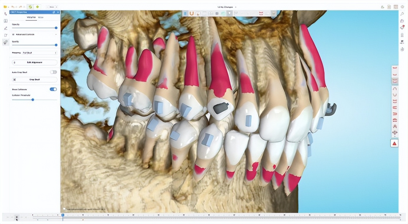 口腔器械日报第22期：全球多家牙科公司第二季度财报公布