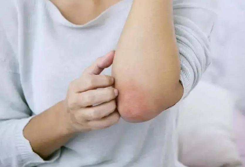 脖子和腋下的小肉粒如何治疗,脖子和腋下的小肉粒是什么丝状疣