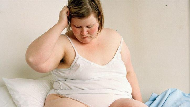 多囊卵巢综合征怎么防脱发,多囊卵巢综合征导致月经推迟长痘