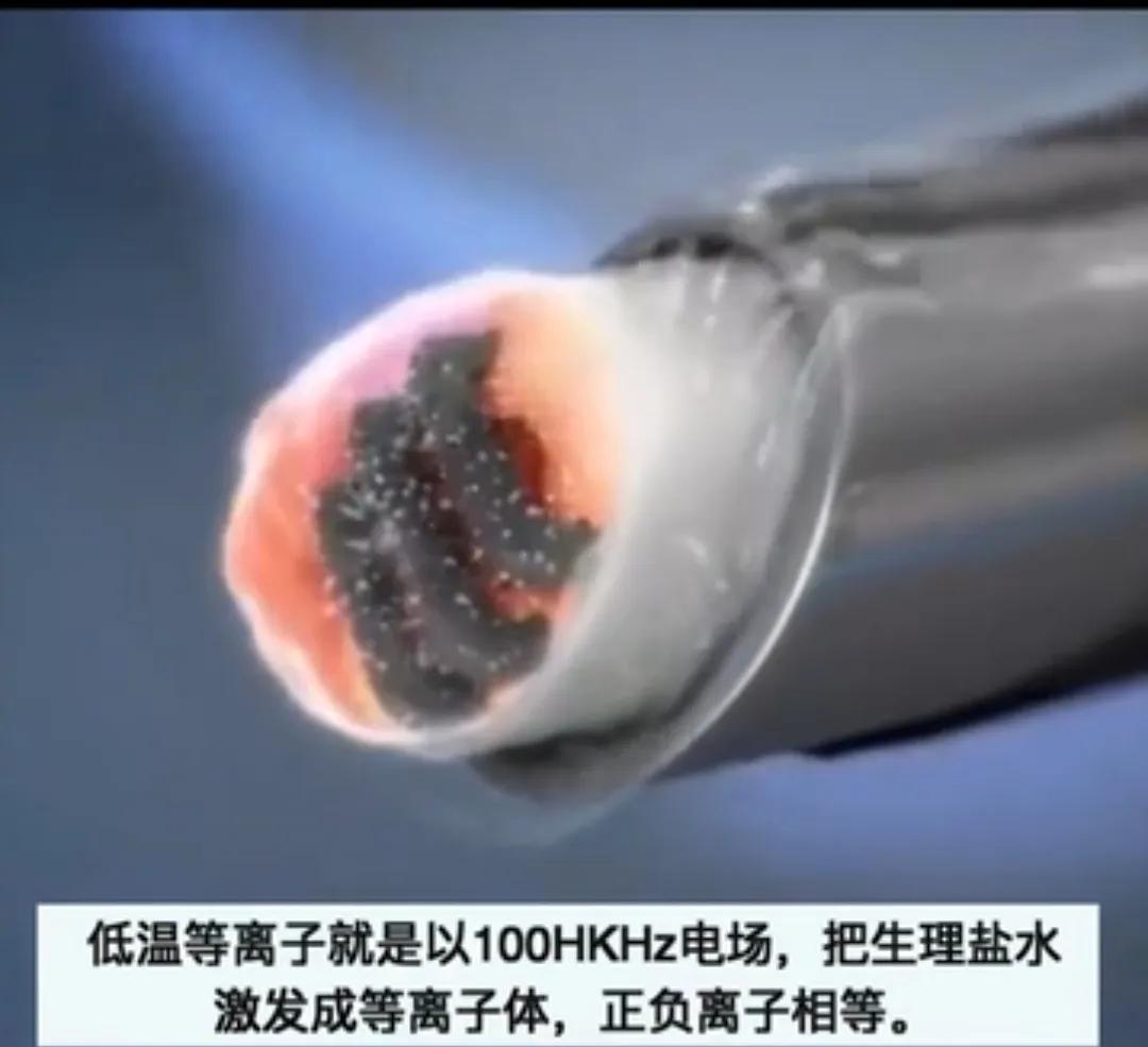 手术等离子刀头作用原理,手术等离子电切技术原理