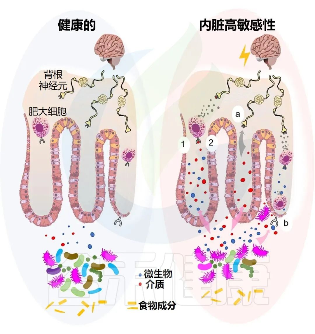 腹胀胃隐痛查不出原因,腹胀腹痛是肠道问题吗