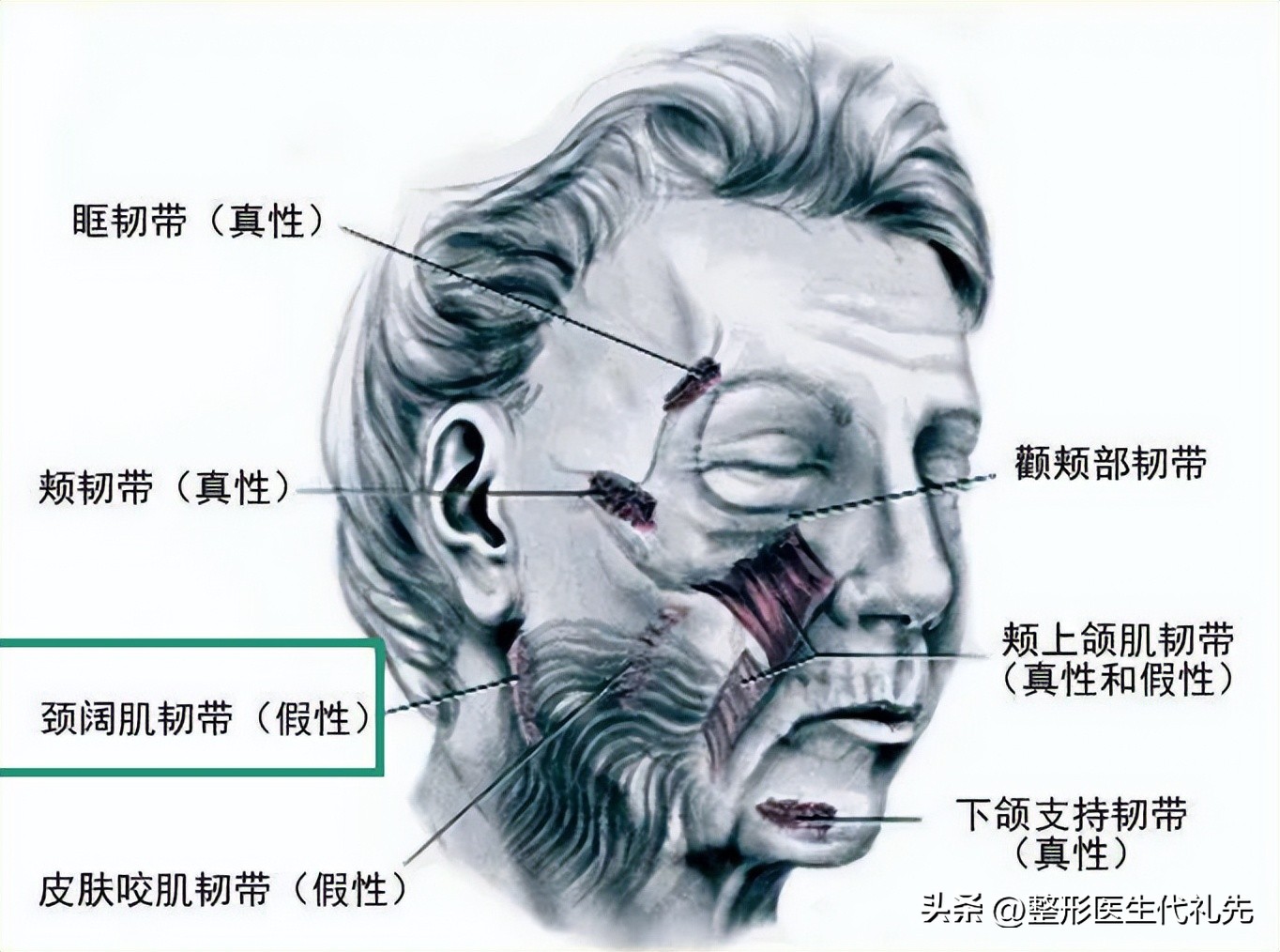 面颊凹陷填充会改善法令纹吗,面颊凹陷下垂如何填充