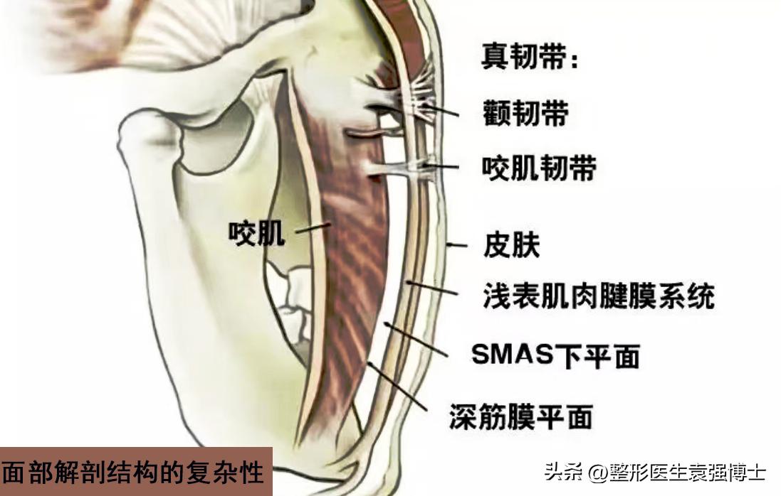 拉皮不剥离会留疤明显吗,拉皮手术如何防止留疤