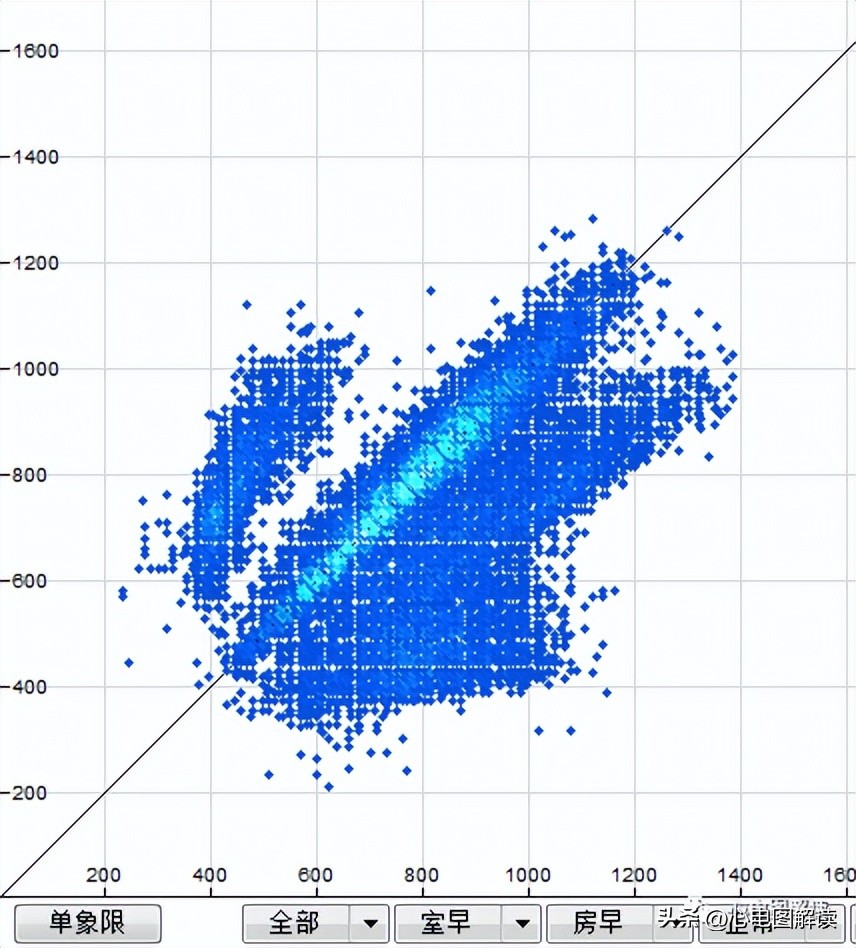 窦性心律偶见室性融合波,室性并行性心律
