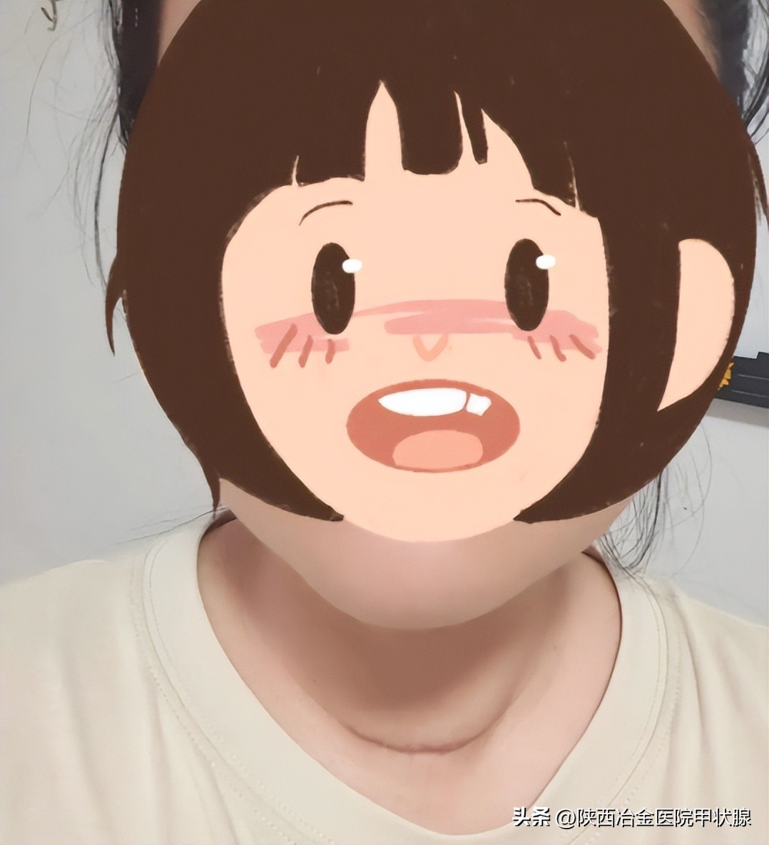 目前消融甲状腺结节手术效果怎样,甲状腺结节消融术后康复效果