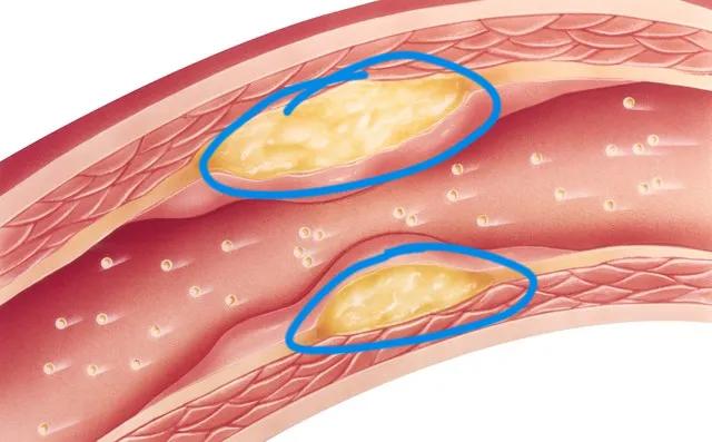 服用阿托伐他汀要复查哪些项目,服用阿托伐他汀后需要复查什么