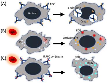 胆管癌光动力治疗,胆管癌做了ptcs还有治愈的可能吗