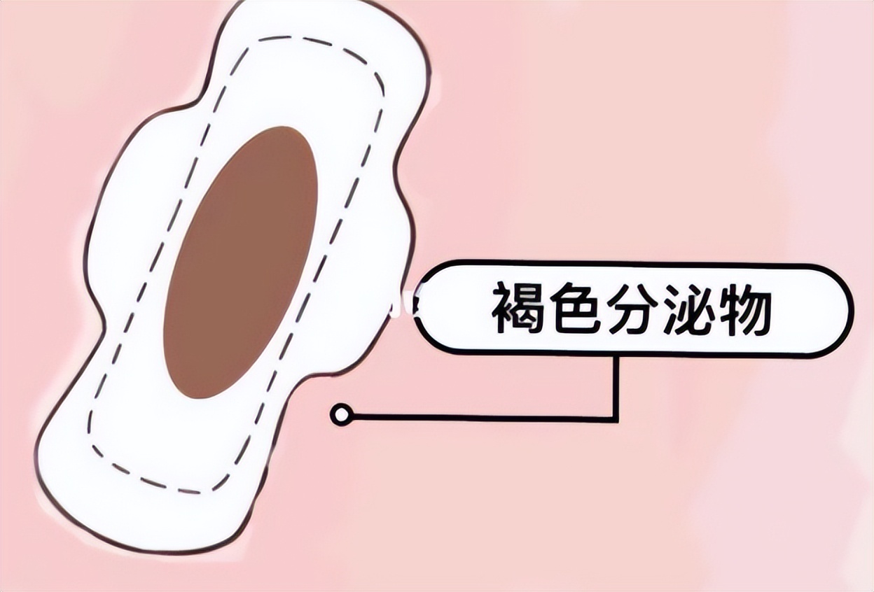 为什么会月经过后有褐色分泌物,为什么月经结束后出现褐色分泌物