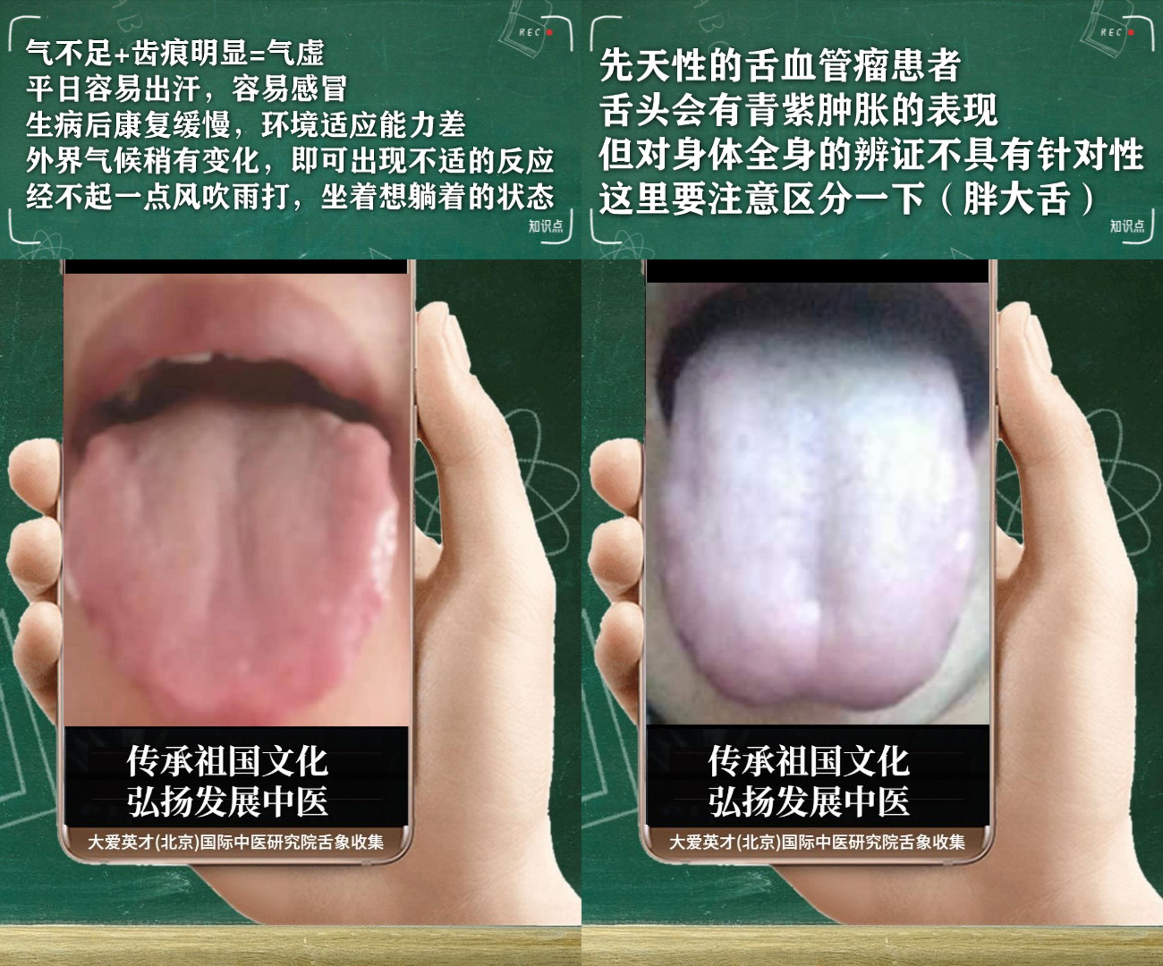 嗜睡肢冷鼻塞中医辨证,中医讲解感冒手脚冰凉