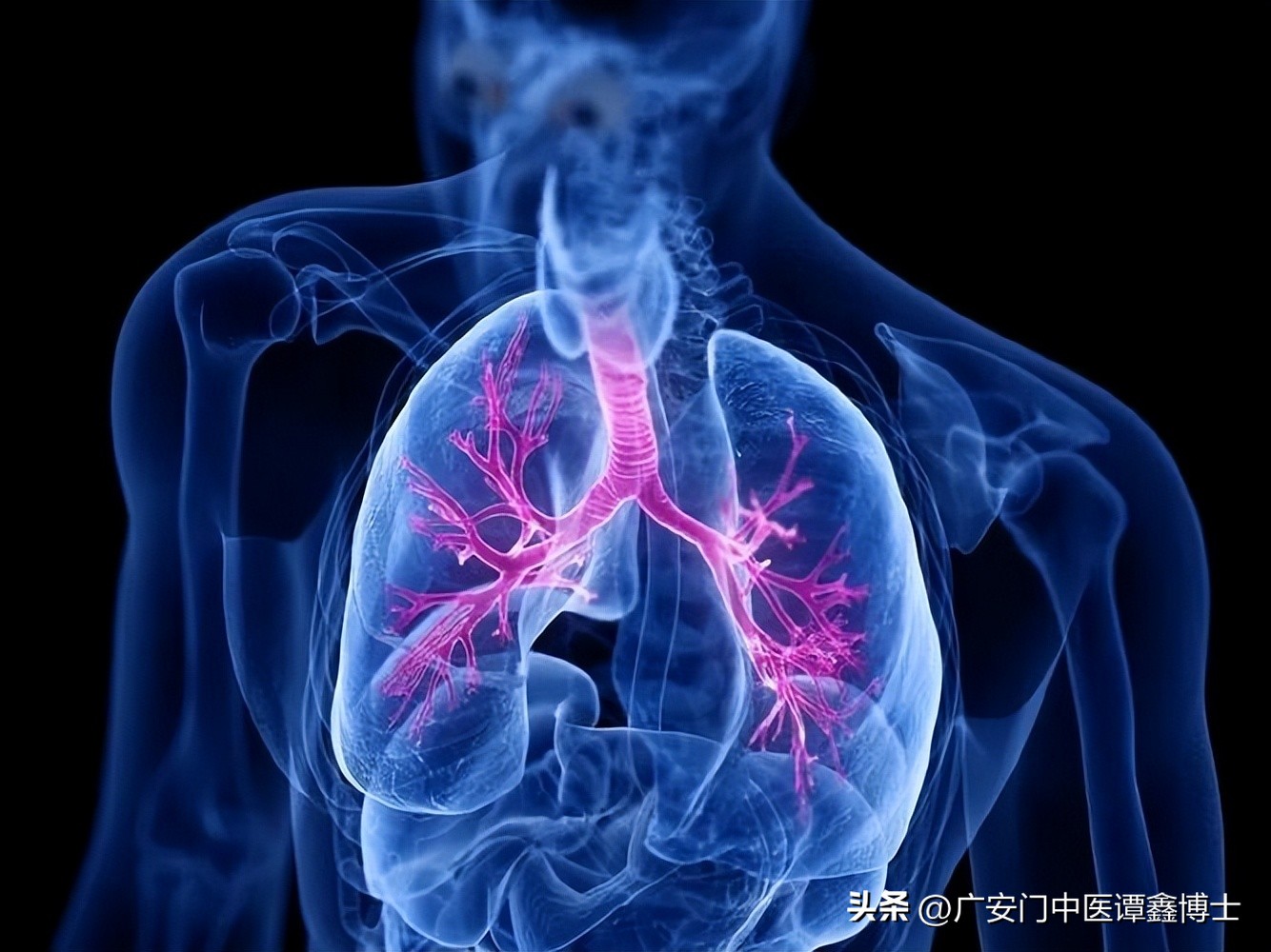 肺癌引起的发热怎么治疗,肺癌病人发热怎么治疗