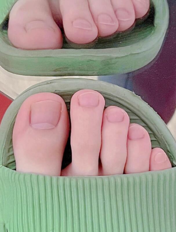 如果染上灰指甲该怎么解决,和有灰指甲的人在一起怎么避免