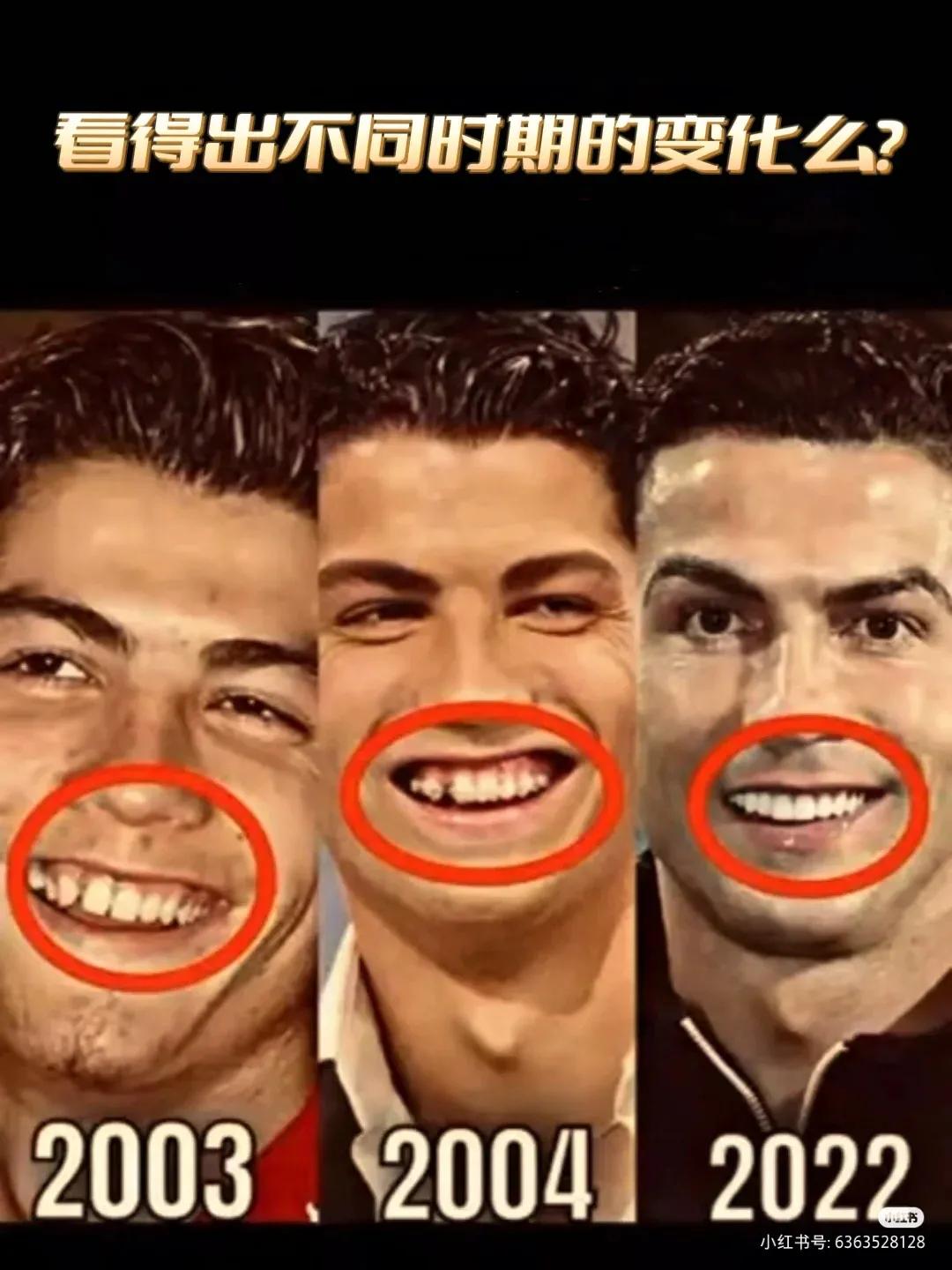 c罗内马尔在一个队吗,内马尔医美项目全过程