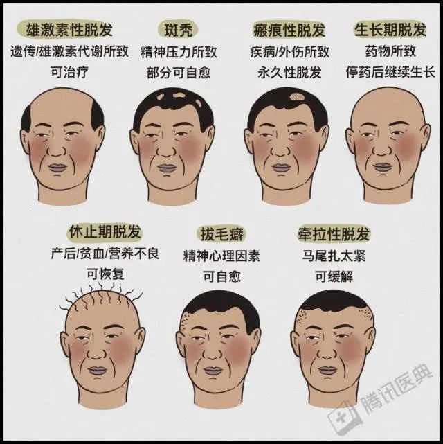 秃顶男子回应不用洗发水长出头发,男子秃顶半月不用洗发水