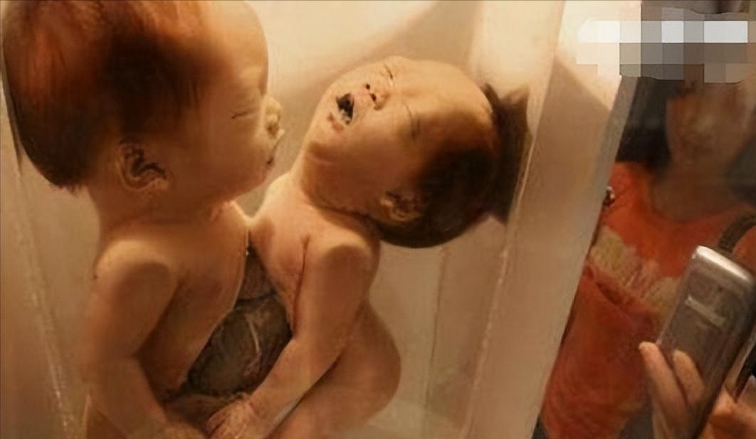 真实恐怖泰国死亡博物馆,泰国恐怖博物馆标本