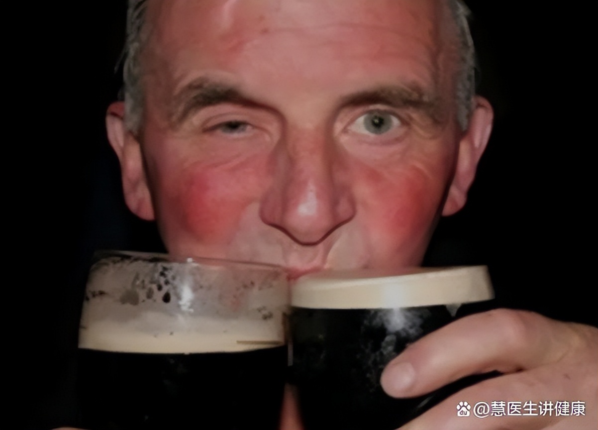 一喝酒就脸红可以喝酒锻炼酒量吗,为什么有的人喝酒容易脸红容易醉