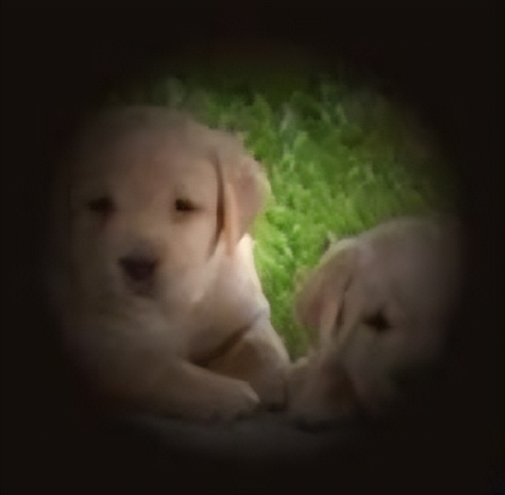 导致眼睛失明的三大眼病,第一大不可逆致盲性眼病