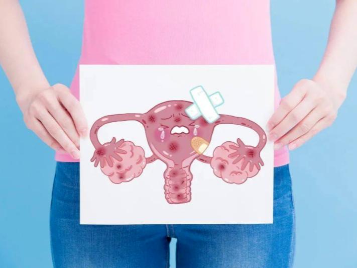 子宫内膜息肉,别再剖宫了,中医有妙方!