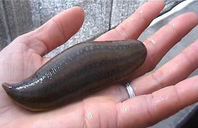 蚂蟥咬了有毒吗,误食蚂蟥会在人体内大量繁殖吗