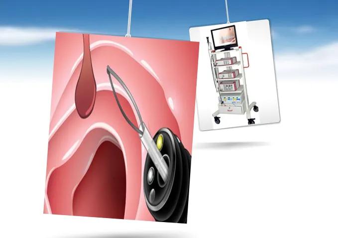 医生建议做宫腔镜意义是什么,宫腔镜检查是什么意思是手术吗