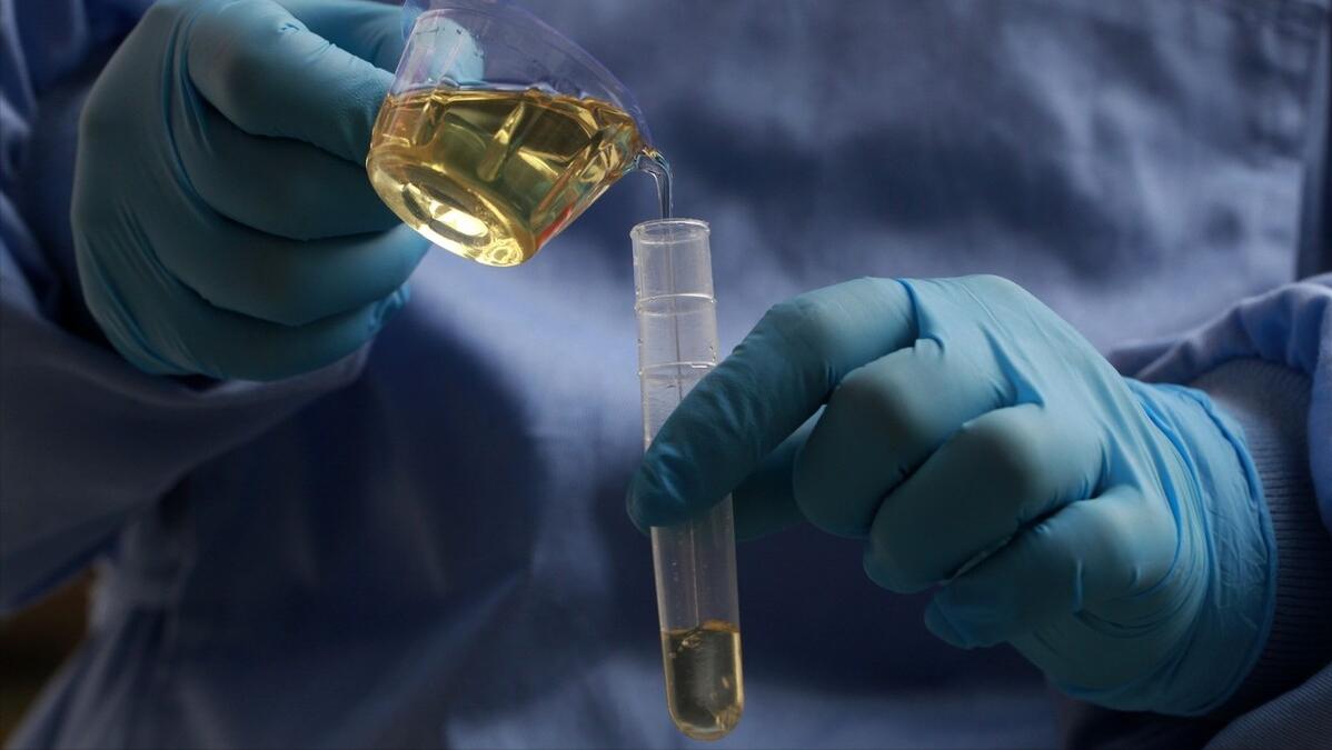 治疗肾病的西药有哪些效果好,肾病前沿治疗又有了新突破