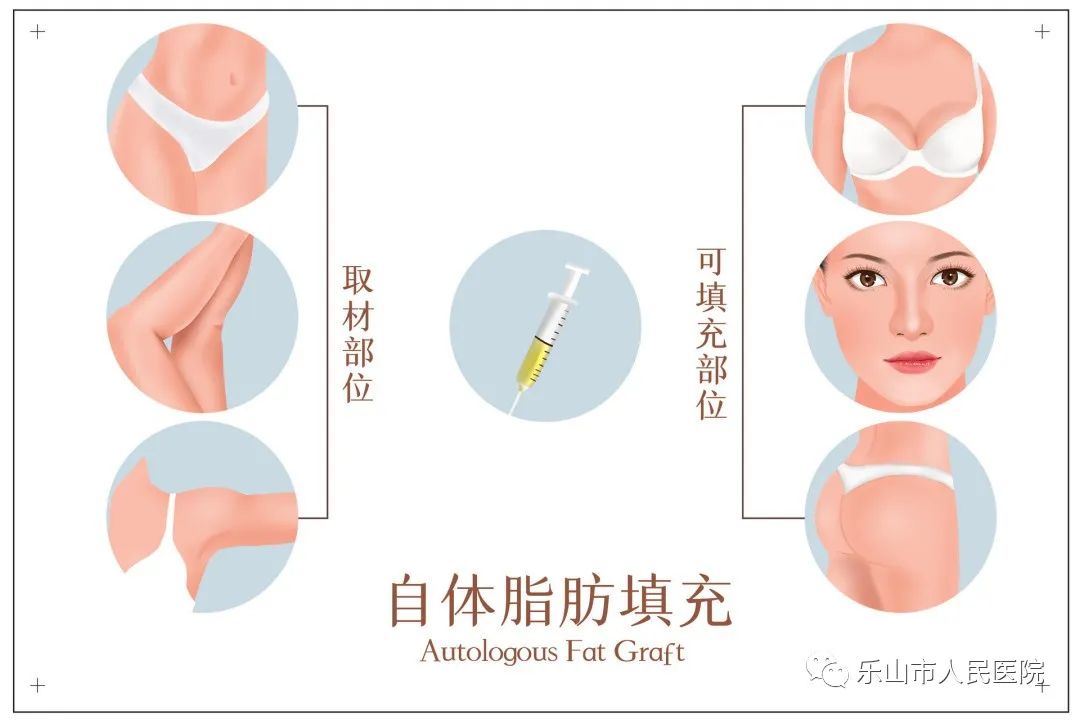 冬天适合做哪些医美项目,秋冬季适合做的医美项目