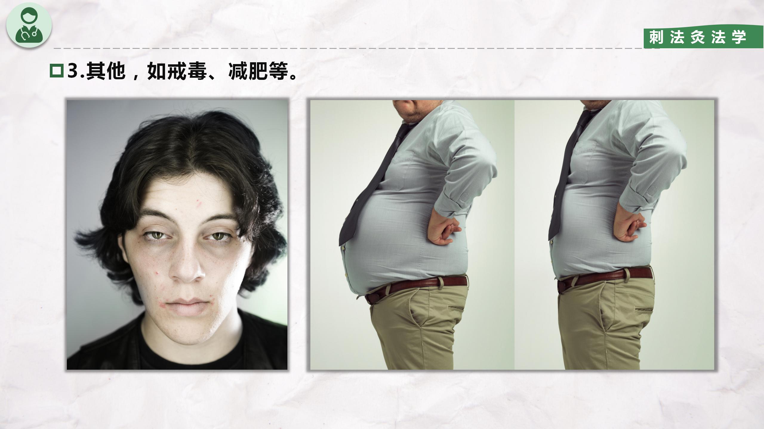 皮内针法知识点,皮内针使用视频