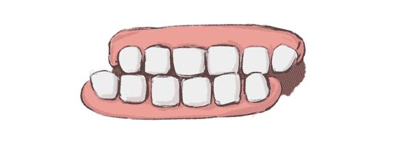 夜间睡觉磨牙是什么毛病,睡觉磨牙是很正常的现象