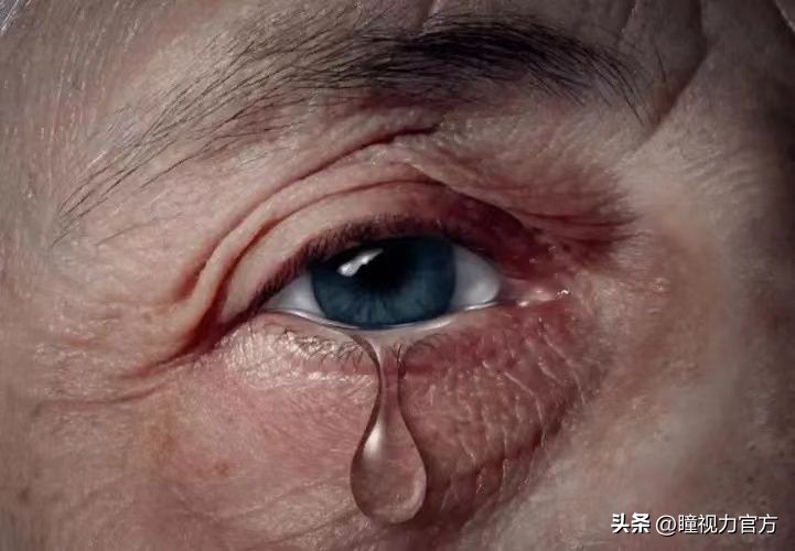 眼睛老是流泪做什么检查,眼睛一直流泪睁不开是什么原因