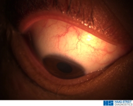 郑州眼科医院全飞秒设备,郑州视光眼科的仪器