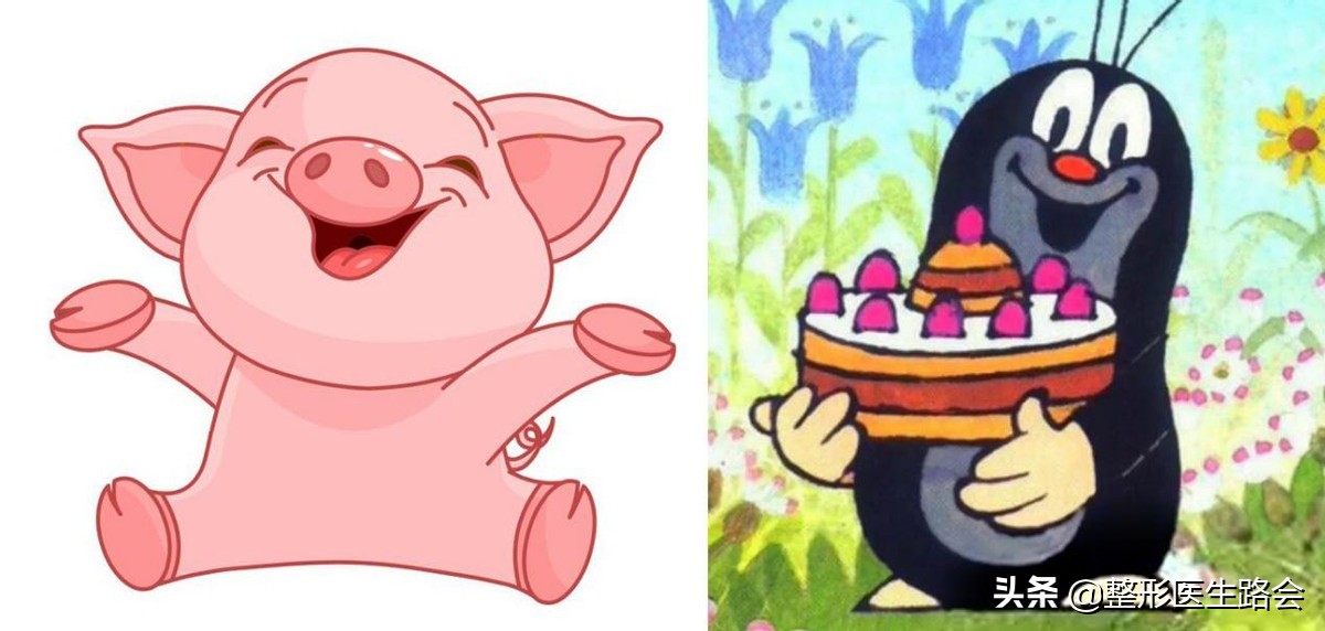 鼻基底填充法令纹瞬间消失,鼻基底填充后法令纹能改善多少