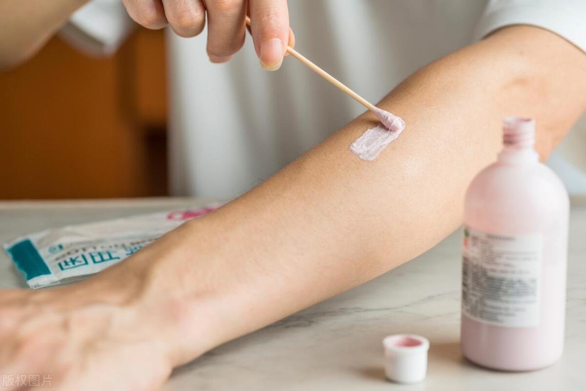 婴儿急性湿疹和慢性湿疹怎么区别,最适用于亚急性湿疹的外用药是