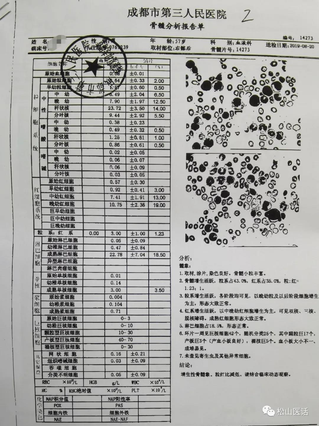 骨髓增生异常综合征输血标准,骨髓增生异常综合征输血能活多久