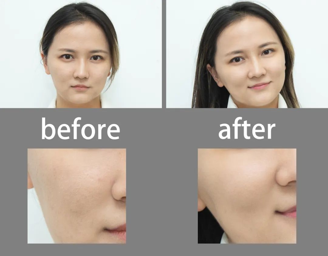 美肌试颜室‖直播见证，4周院线护肤的逆袭之路