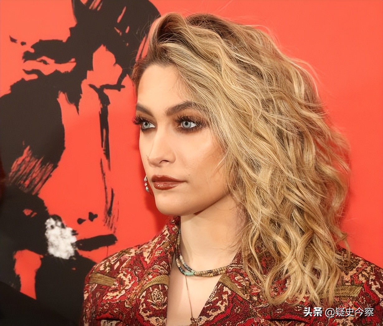 迈克尔杰克逊曾患有白癜风吗,迈克杰克逊去世真相