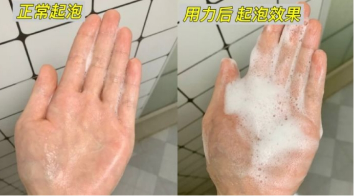 毛躁头发孕妇洗发水推荐,孕妇能用的去屑洗发水推荐