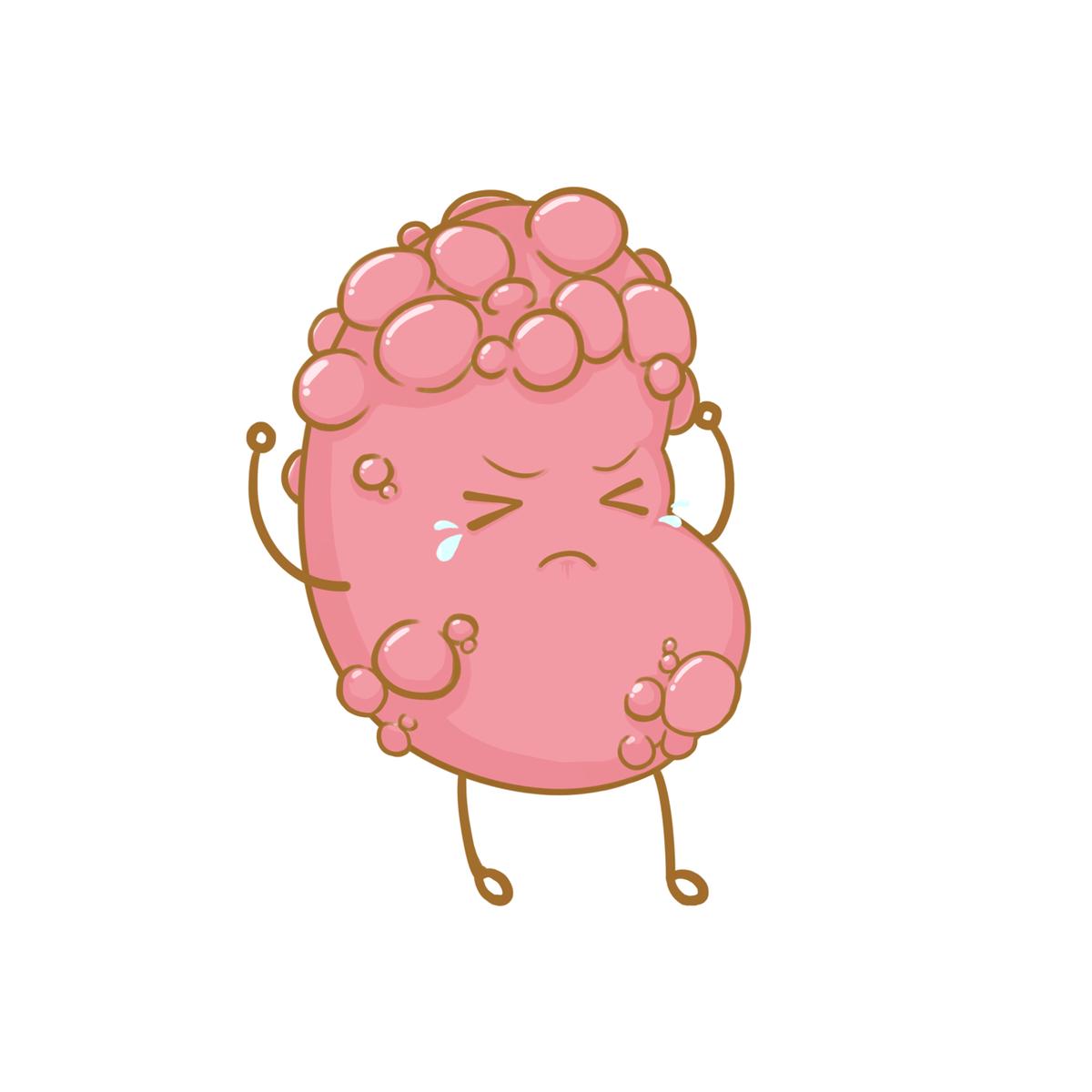 肾脏水泡如何处理,肾脏水泡