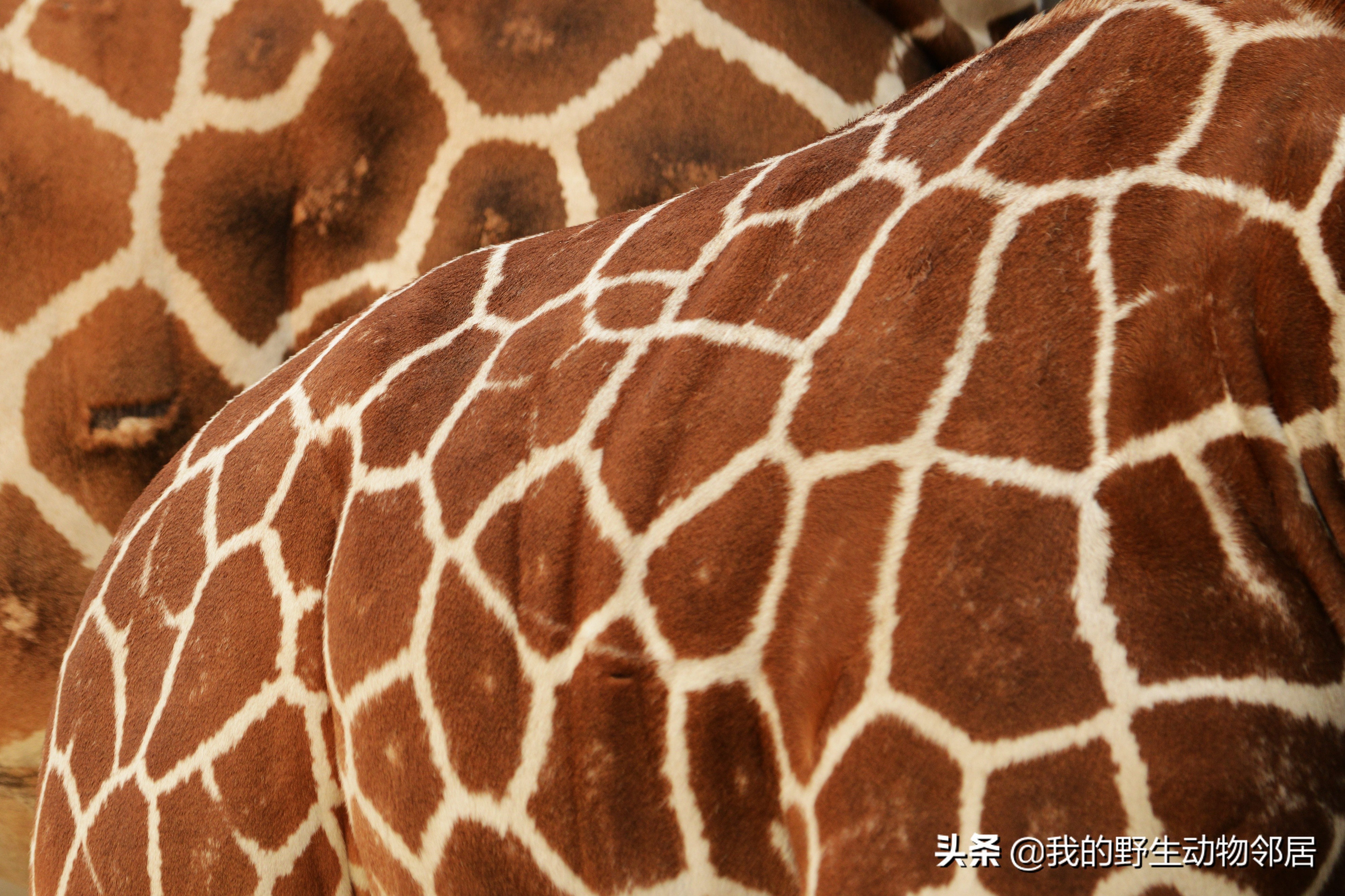 脖子长头发是怎么回事,脖子长淋巴结怎么办