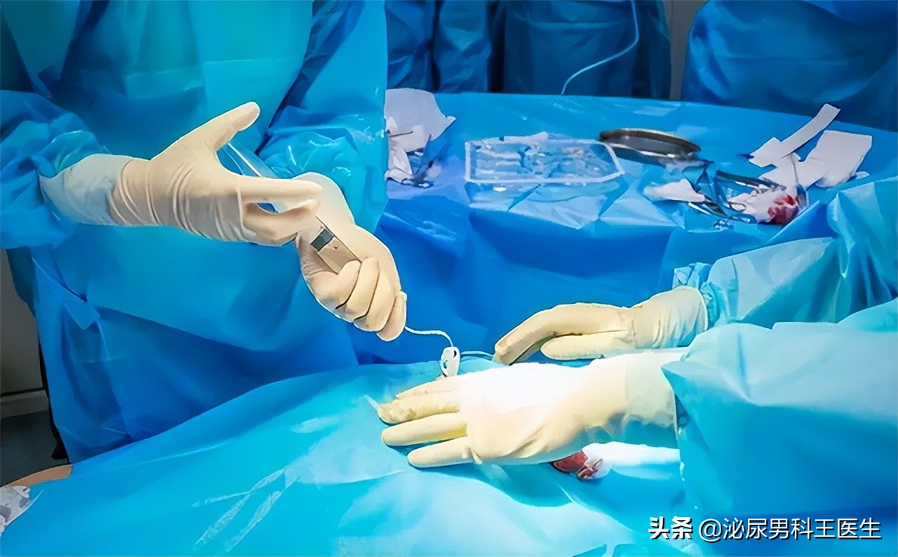 直肠癌的6个早期症状是一起出现,直肠癌出现便秘早期还是晚期