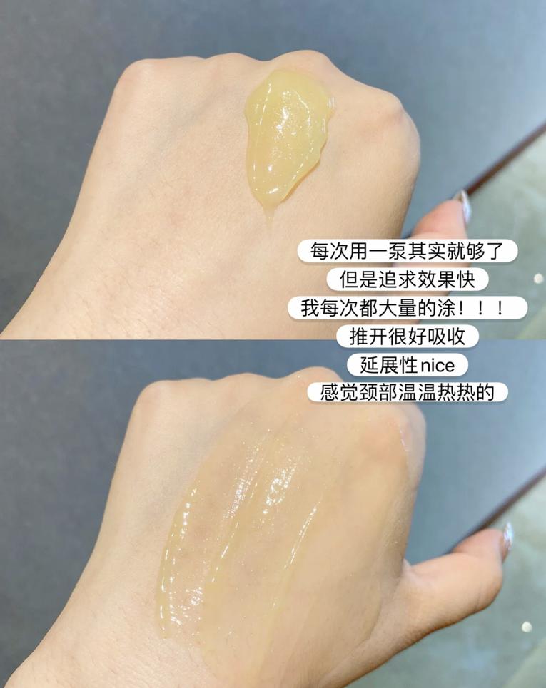 1条颈纹=显老10岁，可怕的颈纹还有救吗？