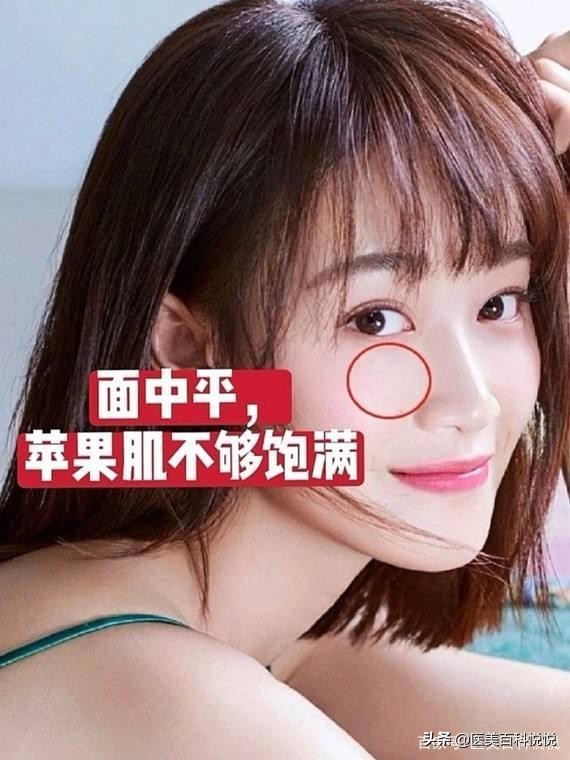 苏王——你是苦相脸吗，苦相脸的人该怎么调整呢？