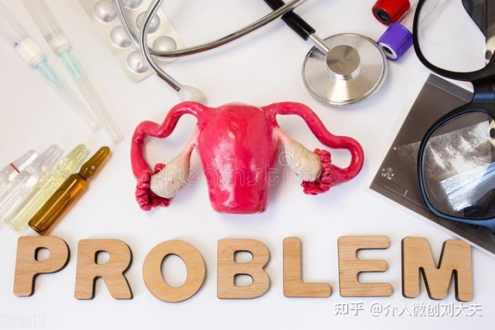 超声介入穿刺治疗巧克力囊肿,介入卵巢巧克力囊肿