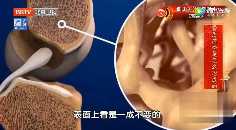 骨质疏松吃什么钙最能吸收,骨质疏松吃哪种钙补得快