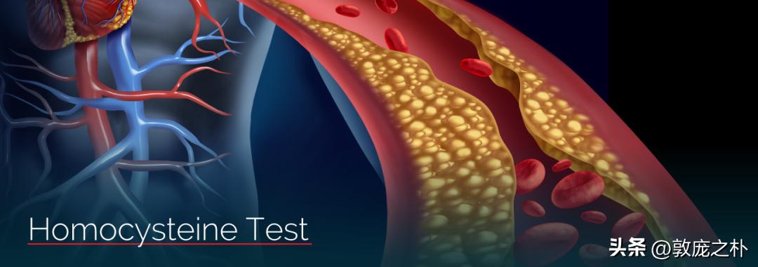 为什么会产生很多同型半胱氨酸 (为什么会出现同型半胱氨酸)