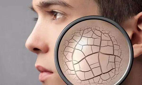 冬天地暖太干燥如何解决,地暖屋里太干燥加湿的方法