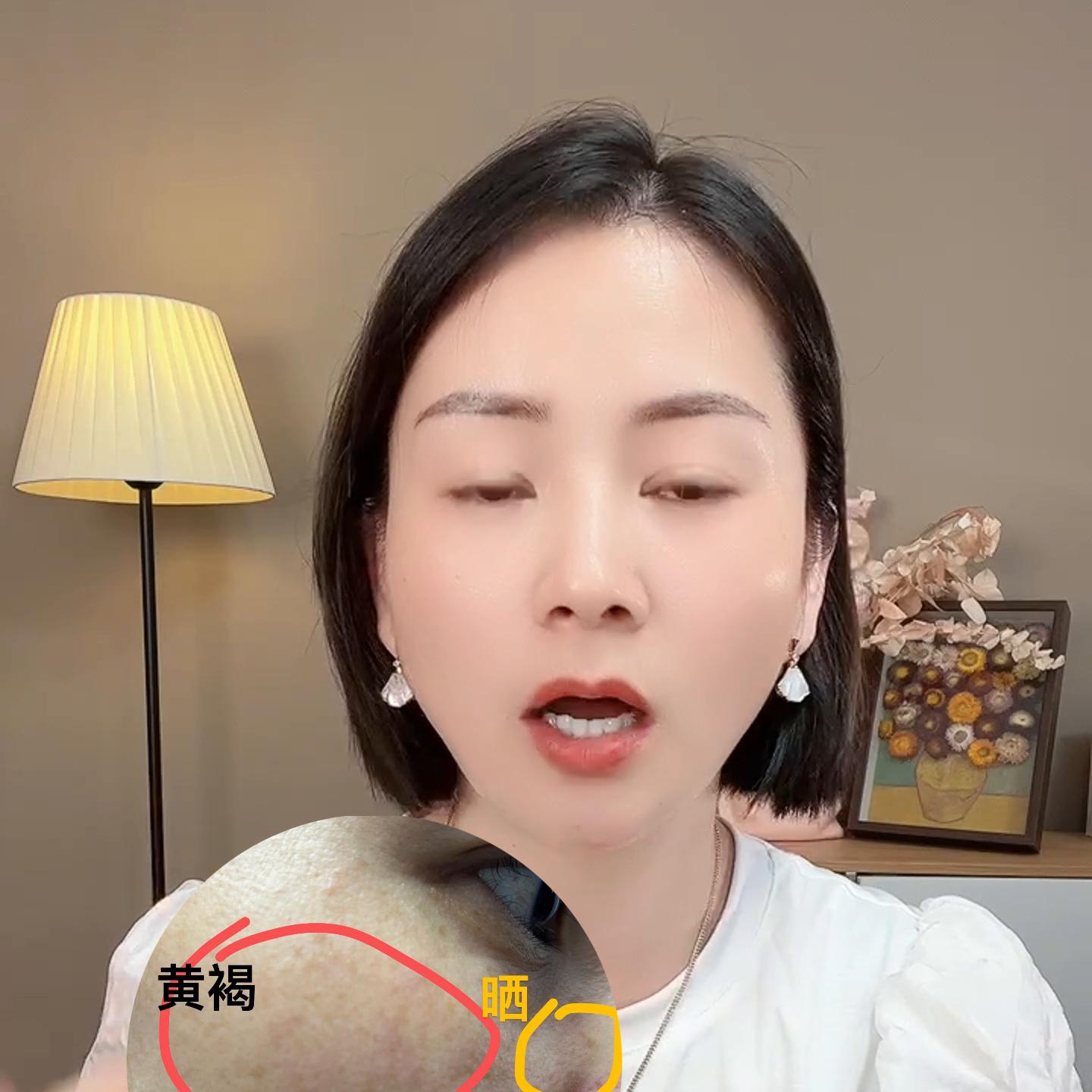 生理盐水加传明酸湿敷,传明酸怎么用最有效