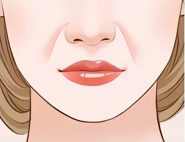 小拉皮加填充法令纹做好休息多久,法令纹严重是做拉皮还是做填充好