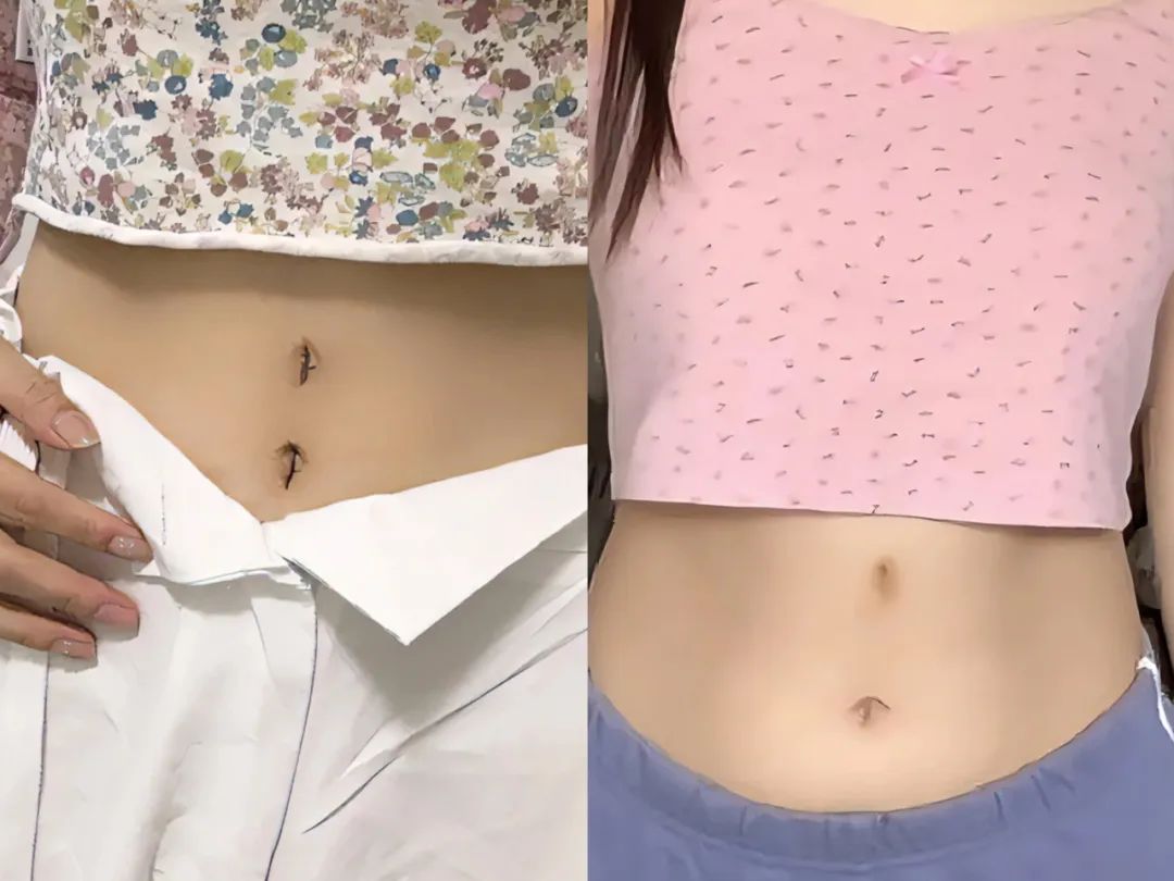 胸大被骂、胸小自卑，中国女孩有多「假」