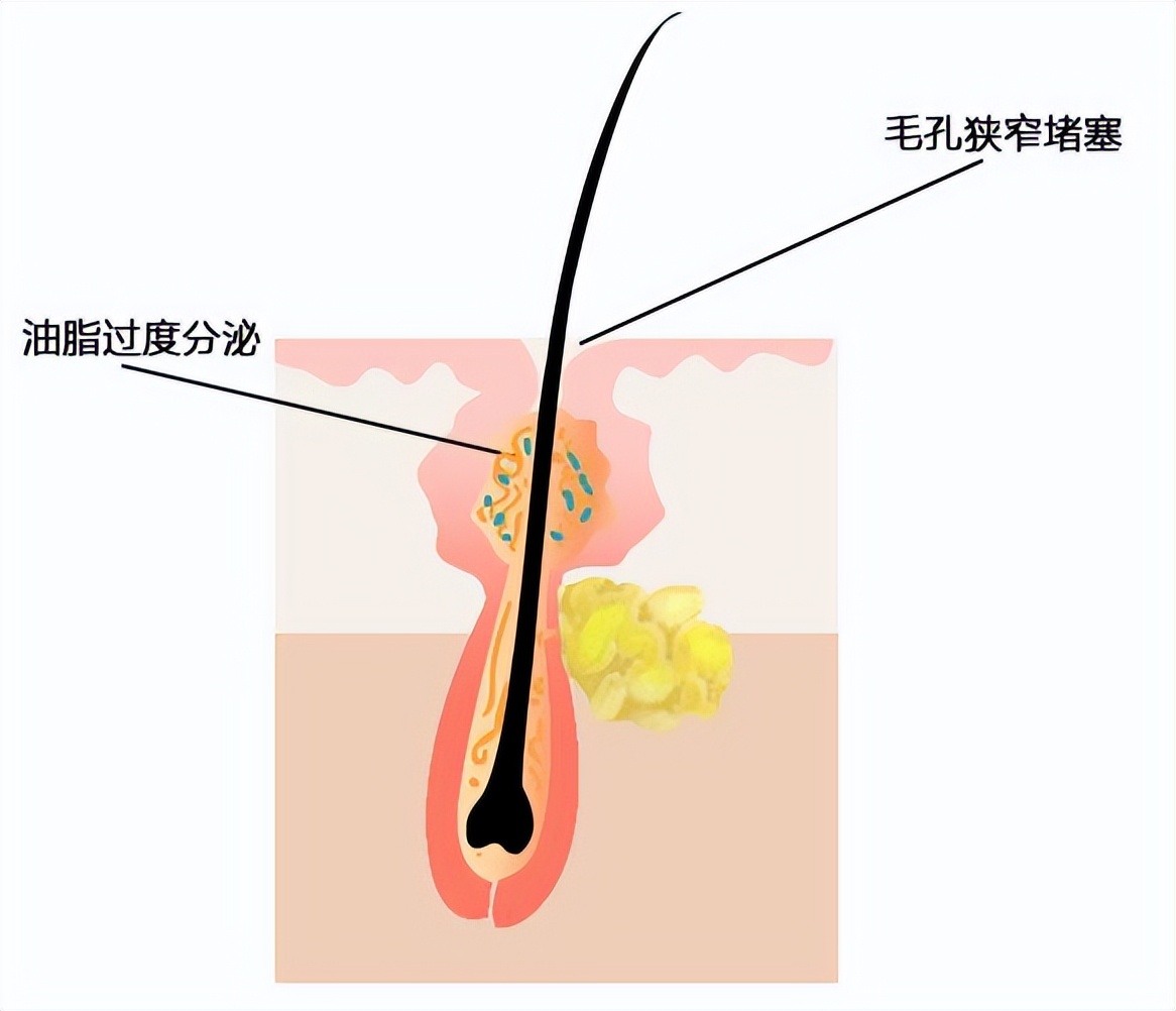 让你又爱又恨的面霜,让人们又爱又恨的软件